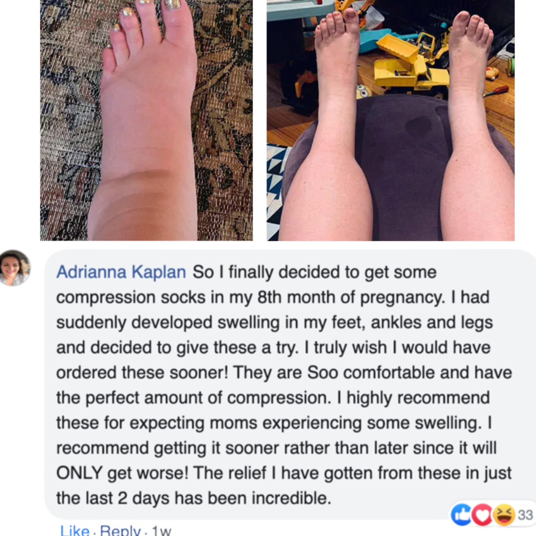 Women’s Support Compression Socks | Pregnancy Fit